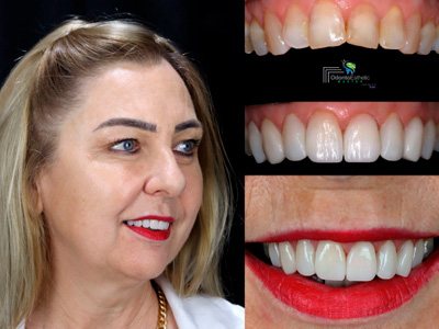 Estética Dental Cruz Alta