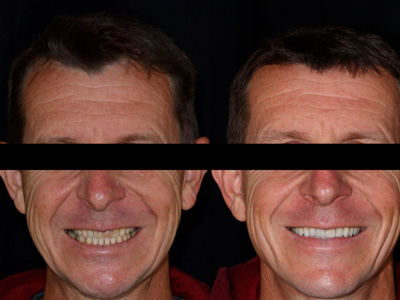 Estética Dental Cruz Alta